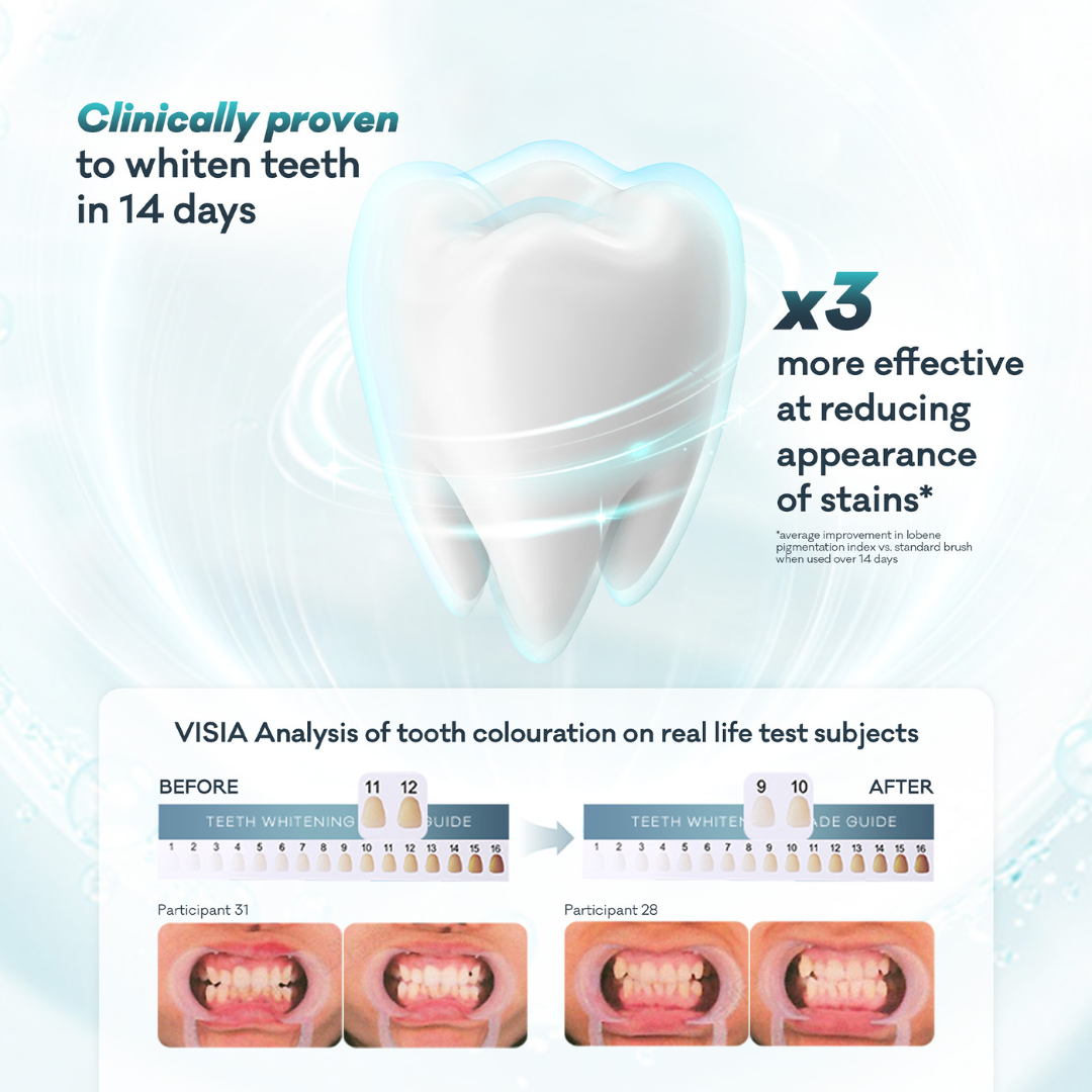 The Ultimate Whitening Bundle